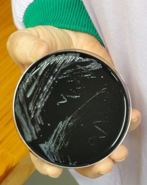 Cultured legionella bacteria on black media